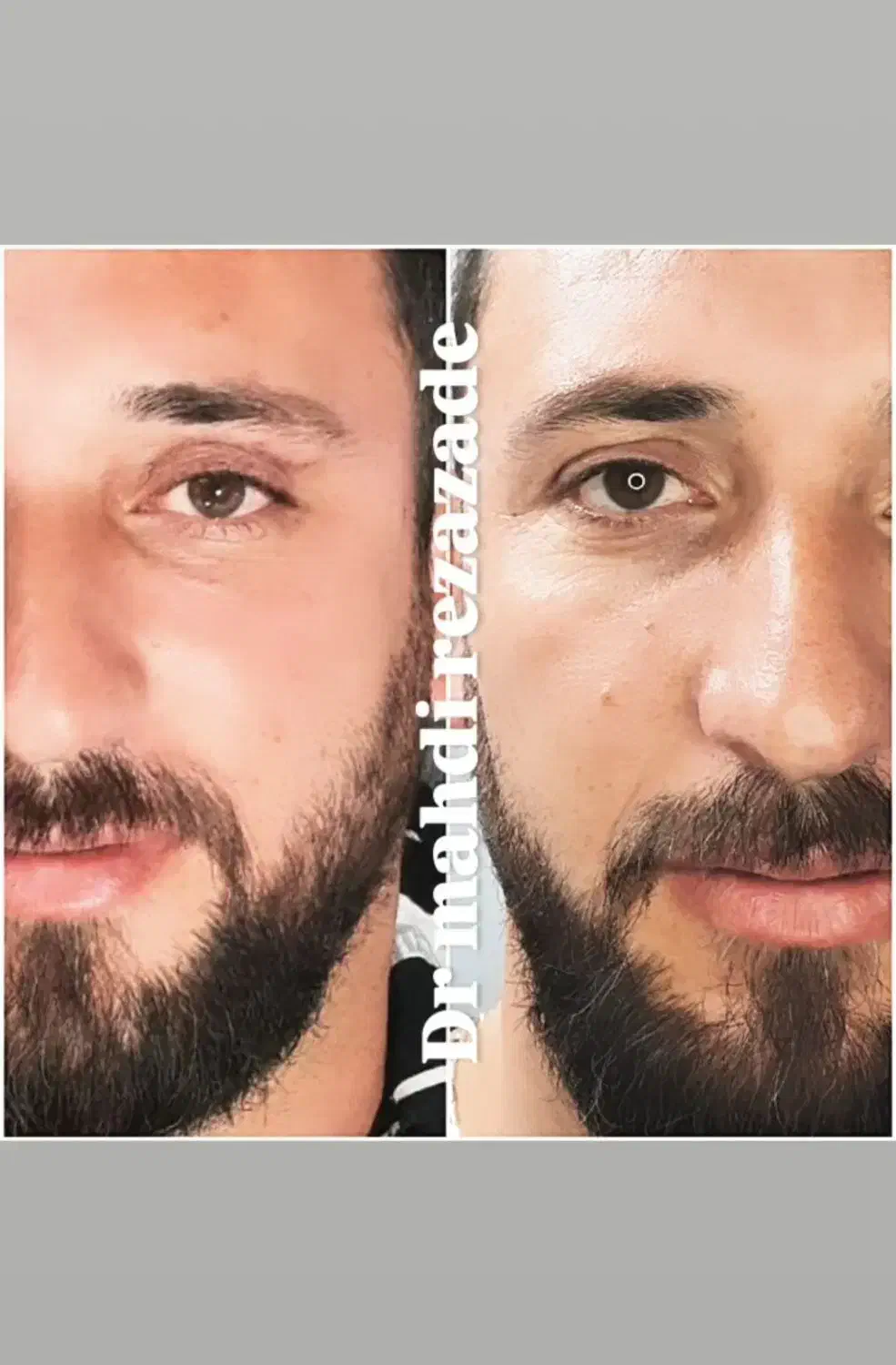 جراحی زیبایی، ساکشن|خدمات آرایشگری و زیبایی|مشهد, هفت تیر (حافظ)|دیوار