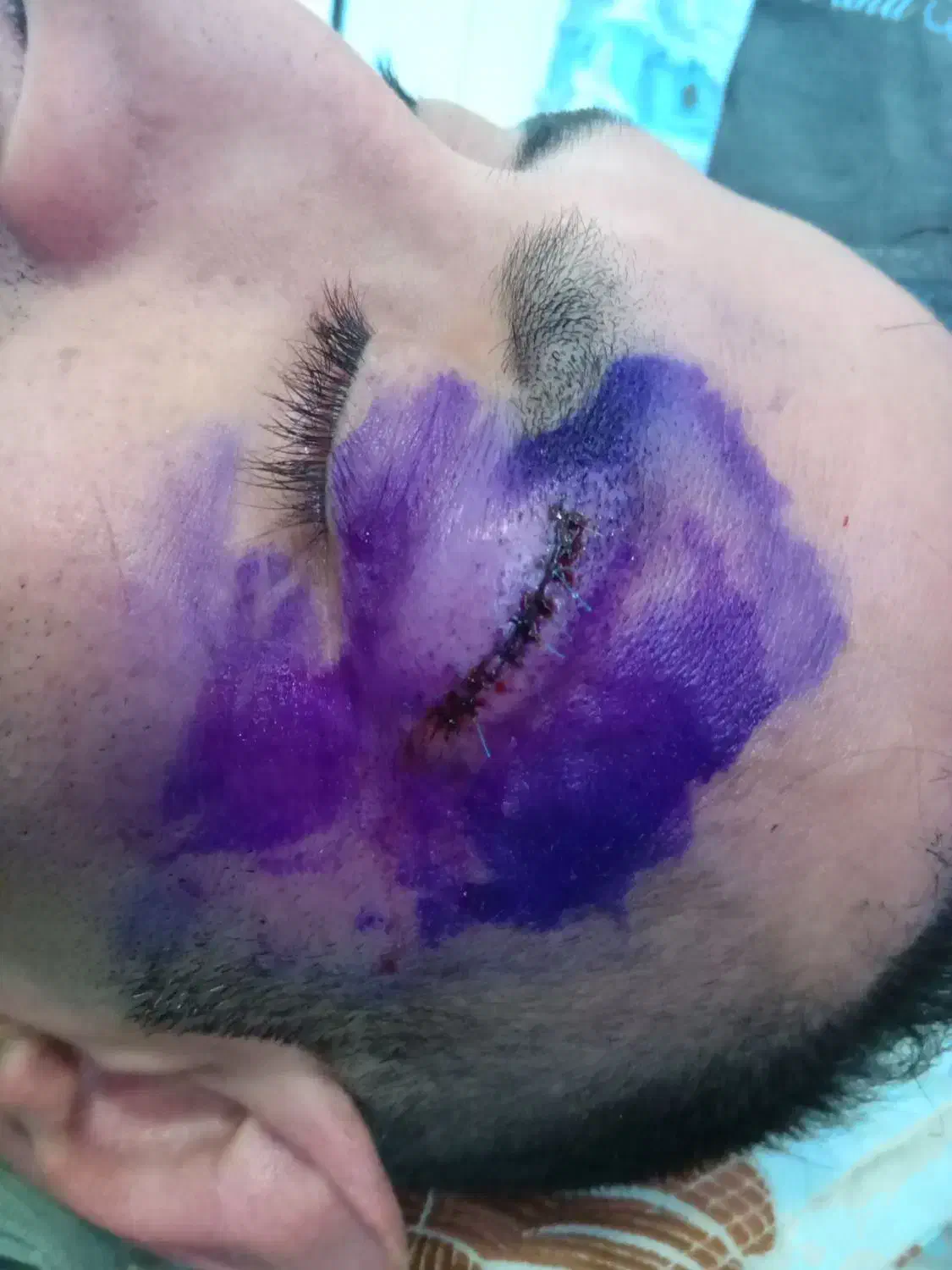 خدمات پرستاری در منزل.|خدمات آرایشگری و زیبایی|نجف‌آباد, هفده شهریور|دیوار