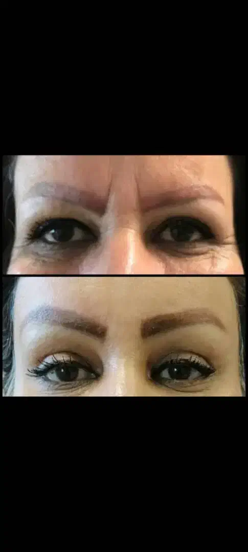 قسطی جراحی بینی و پیکرتراشی و لیفت صورت و ژل|خدمات آرایشگری و زیبایی|تبریز, |دیوار