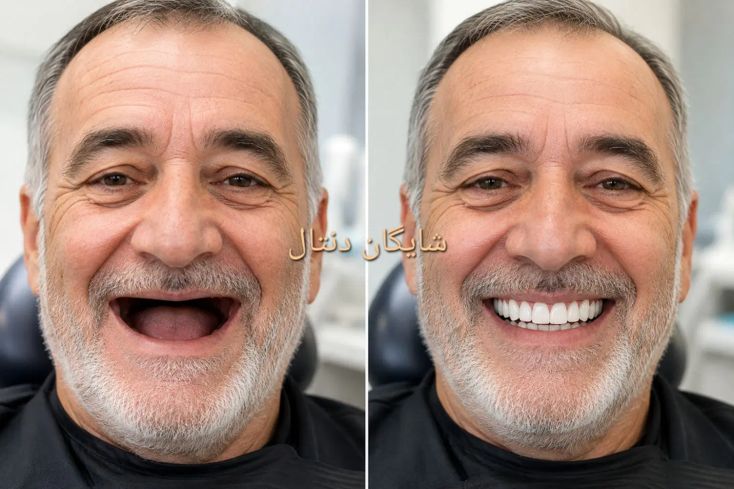 دندان مصنوعی، دست دندان،تعمیرات،دندانسازی|خدمات زیبایی و سلامت|تهران, هاشمآباد|دیوار