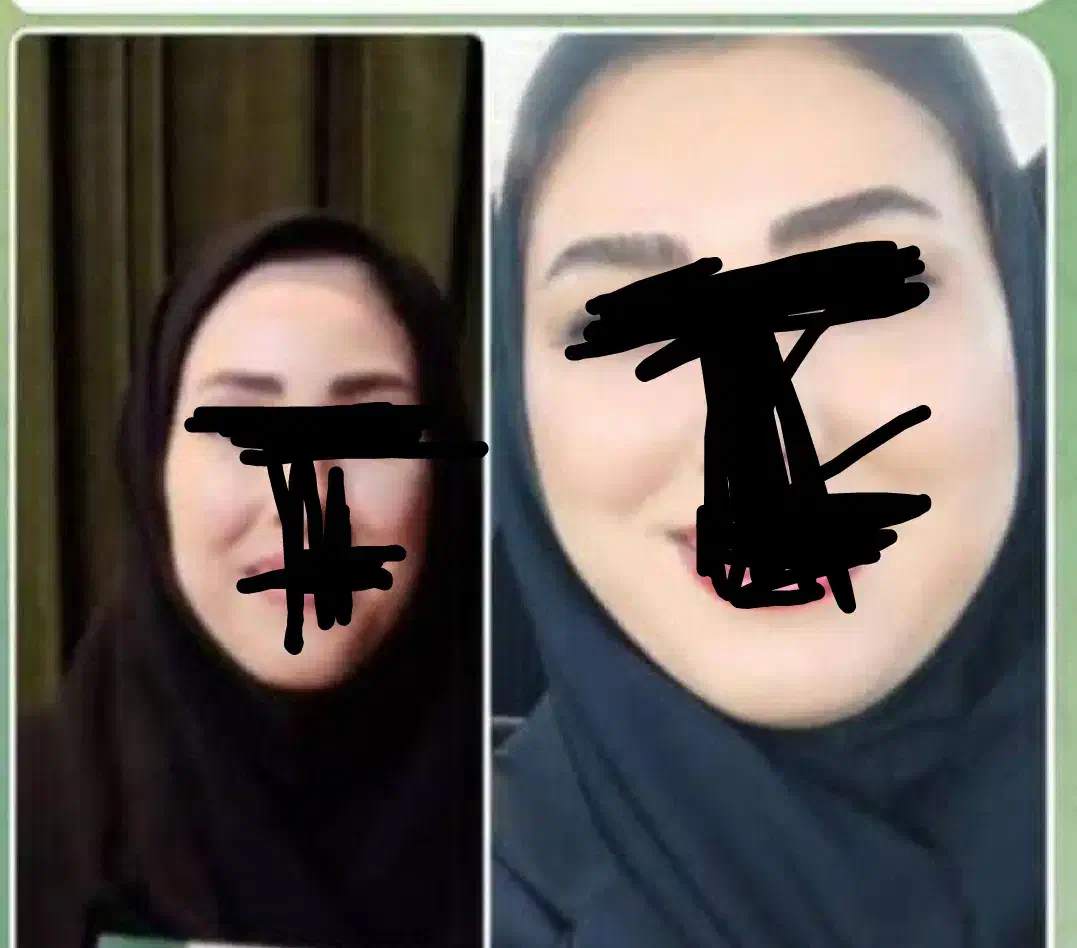 چاقی صورت.|خوردنی و آشامیدنی|تربت‌حیدریه, پائین ولایت|دیوار