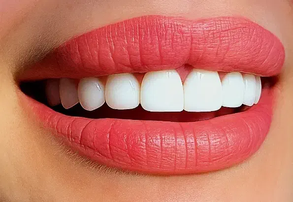 خدمات دندانپزشکی|خدمات آرایشگری و زیبایی|پارسآباد, |دیوار