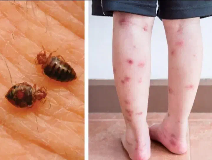 سمپاشی سوسک|خدمات نظافت|کردکوی, |دیوار