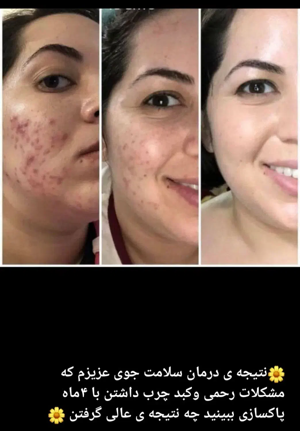 درمانگری باضمانت|خدمات آموزشی|محمدیه-قزوین, |دیوار