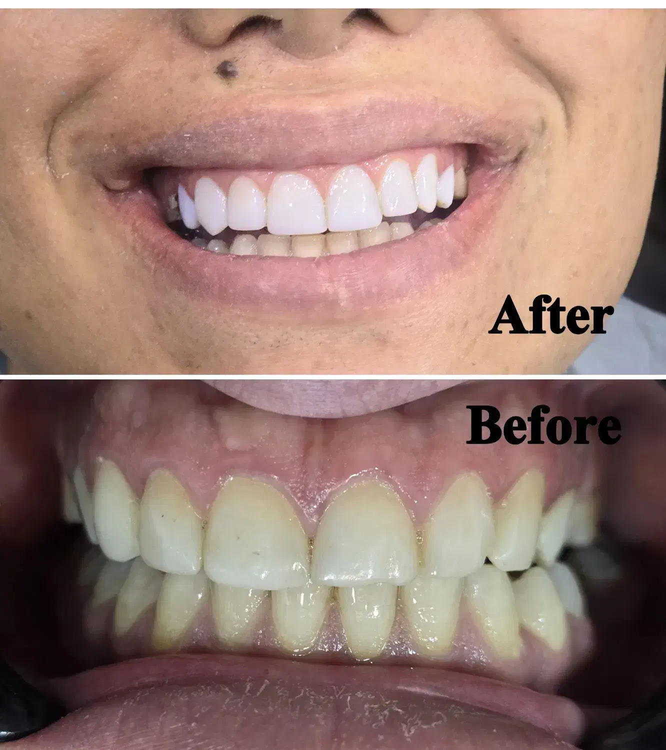 جشنواره دندانپزشکی اقساطی بدون پیش پرداخت|خدمات آرایشگری و زیبایی|شیراز, ستارخان|دیوار