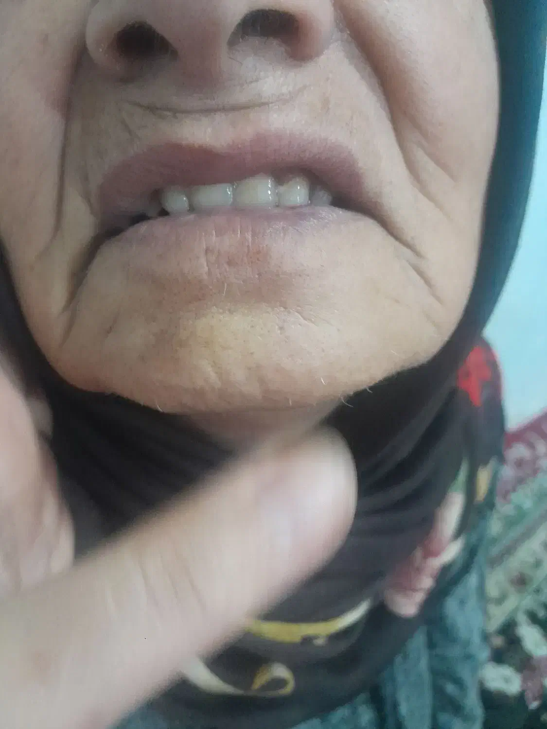 راهنمایی دندان مصنوعی|فعالیت داوطلبانه تحقیقاتی|اصفهان, دانشگاه اصفهان|دیوار