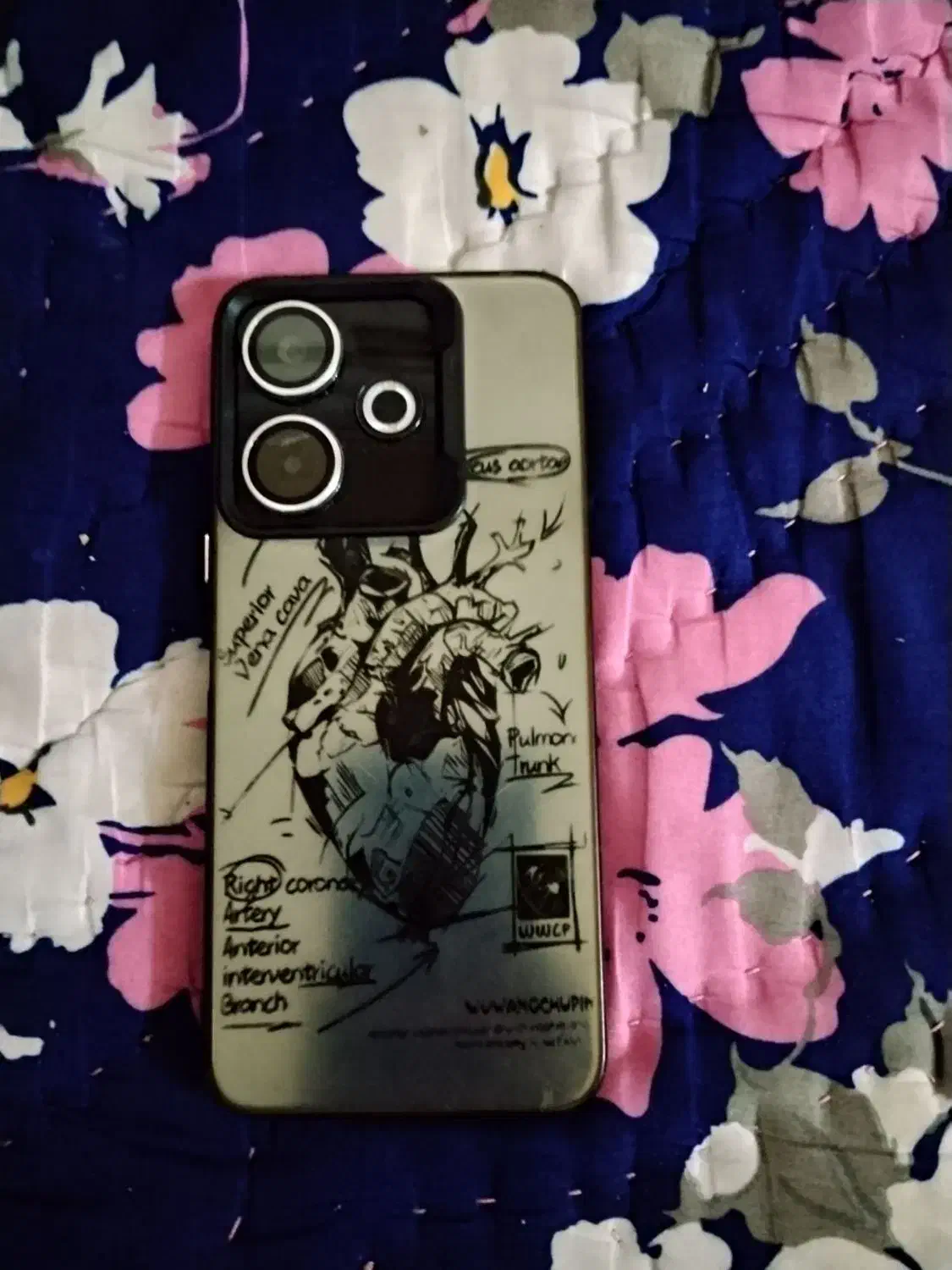 ردمی 13|موبایل|تاکستان, |دیوار