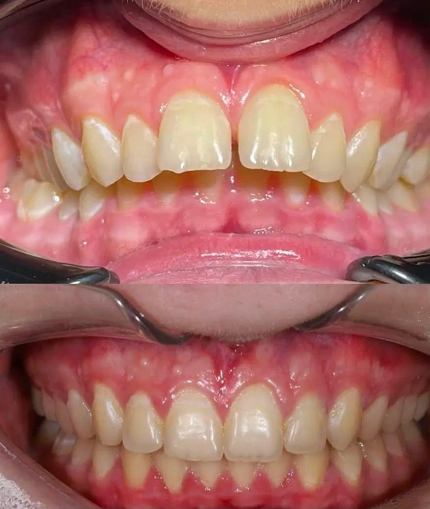 ارتودنسی از دم قسط، هرفک 55 میلیون (فقط تا 1 هفته)|خدمات زیبایی و سلامت|تهران, دروس|دیوار