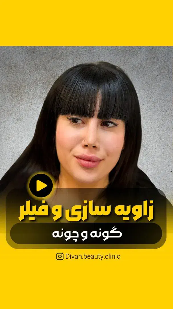 کلینیک زیبایی پوست ومو ولاغری دیوان|خدمات آرایشگری و زیبایی|تهران, سعادت‌آباد|دیوار