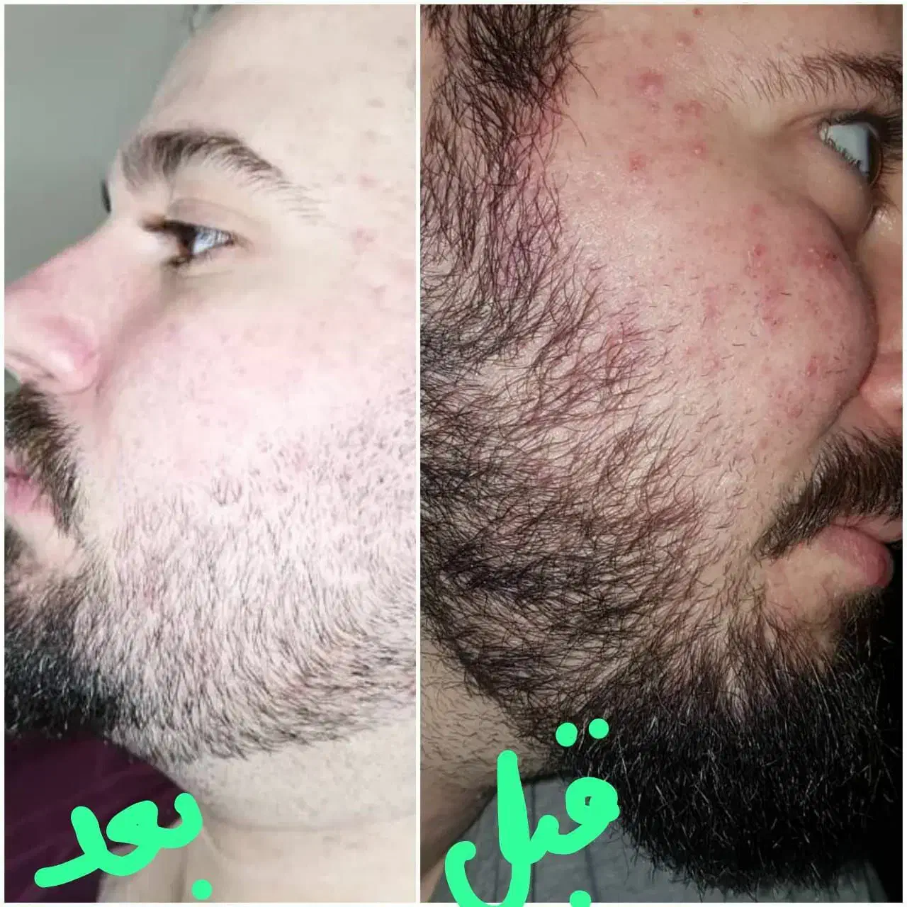 مشاوره تخصصی پوست و موی شما|آرایشی، بهداشتی، درمانی|جیرفت, |دیوار