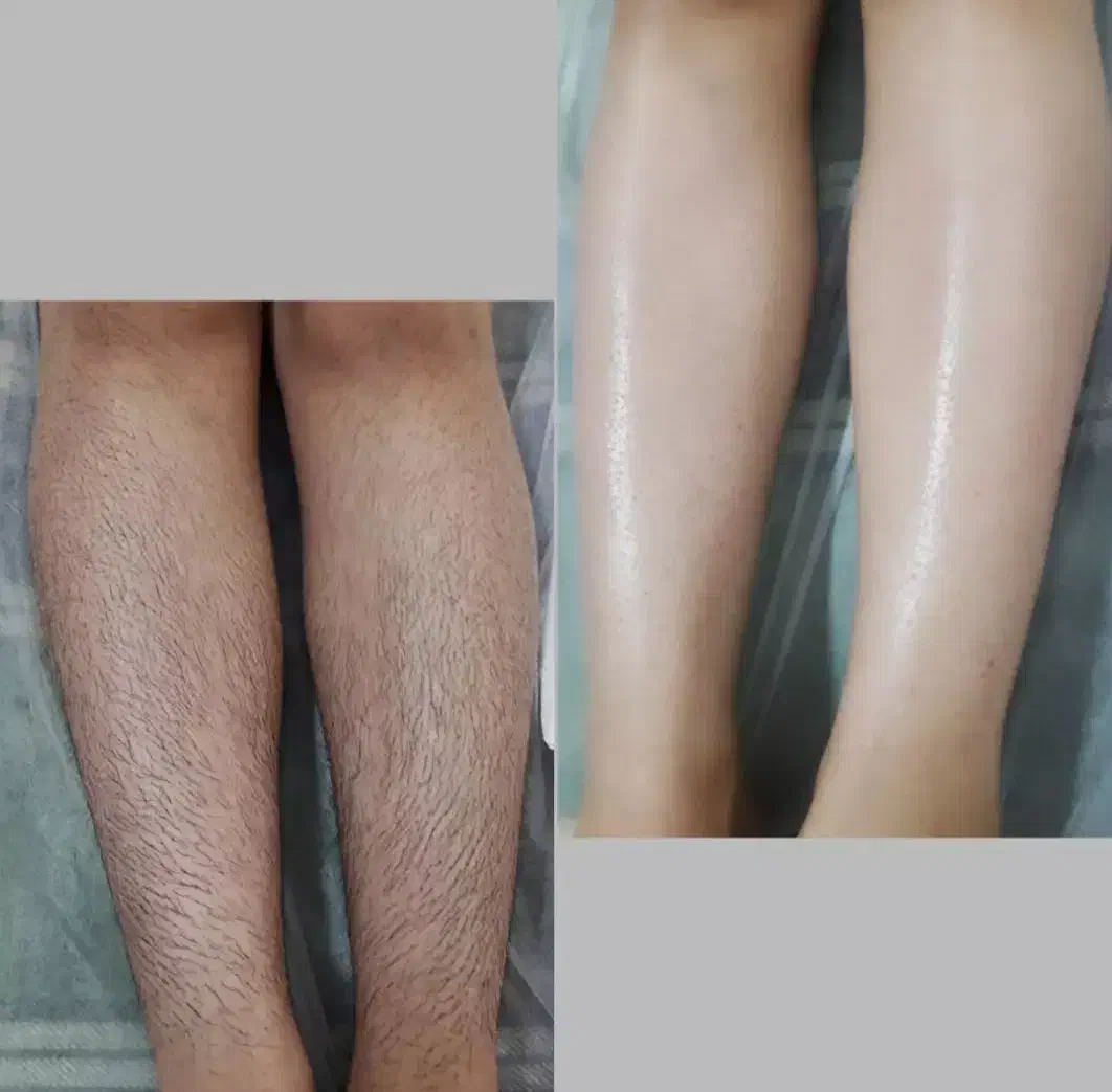 اپیلاسیون تخصصی بانوان|خدمات آرایشگری و زیبایی|نیشابور, هفده شهریور|دیوار