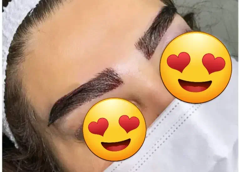 کاشت موی طبیعی و تضمینی، تزریق ژل و بوتاکس  ،|خدمات آرایشگری و زیبایی|تبریز, |دیوار