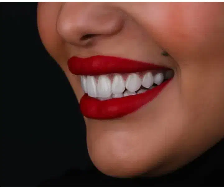 ساخت دندان مصنوعی سرامیکی دریک روز|آرایشی، بهداشتی، درمانی|زابل, |دیوار