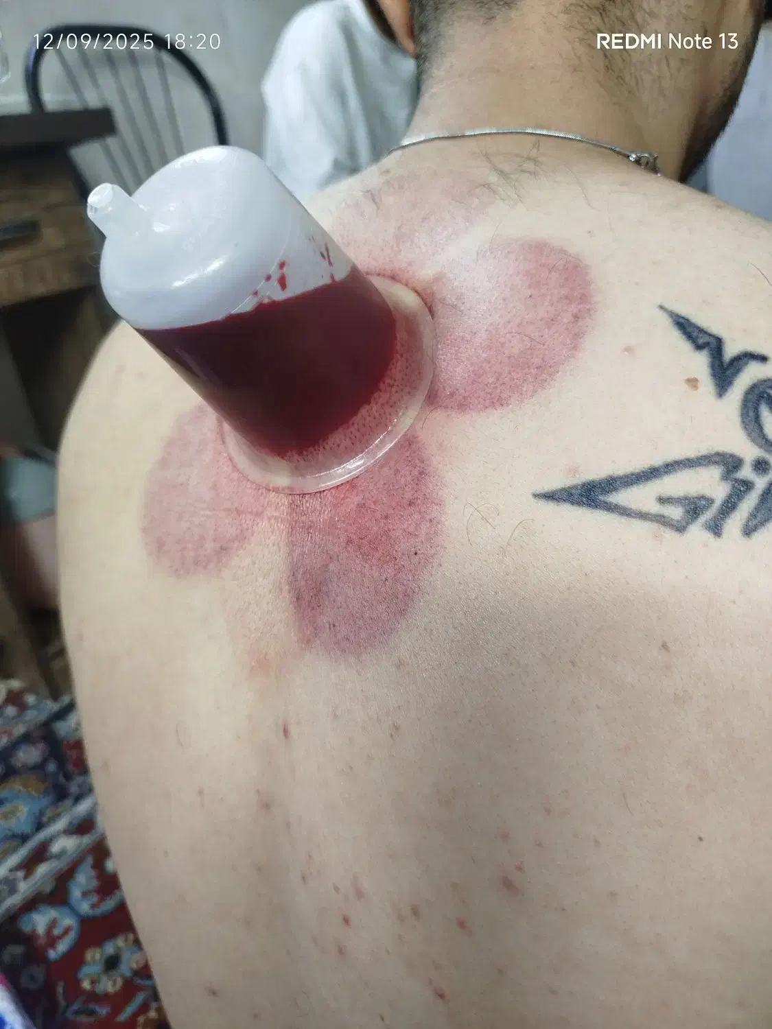 زالو درمانی و حجامت درطب سنتی با ۸ سال سابقه کار|خدمات آرایشگری و زیبایی|سبزوار, شرق کال میانی|دیوار