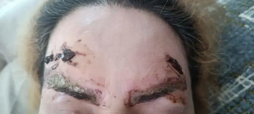 پاک کردن تتو ابرو ریمو تک جلسه ای تضمینی +آموزش|خدمات آرایشگری و زیبایی|خرم‌آباد, |دیوار