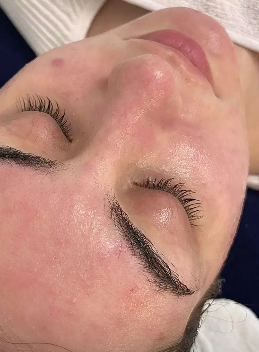 پاکسازی و فیشال پوست|خدمات آرایشگری و زیبایی|میبد, |دیوار