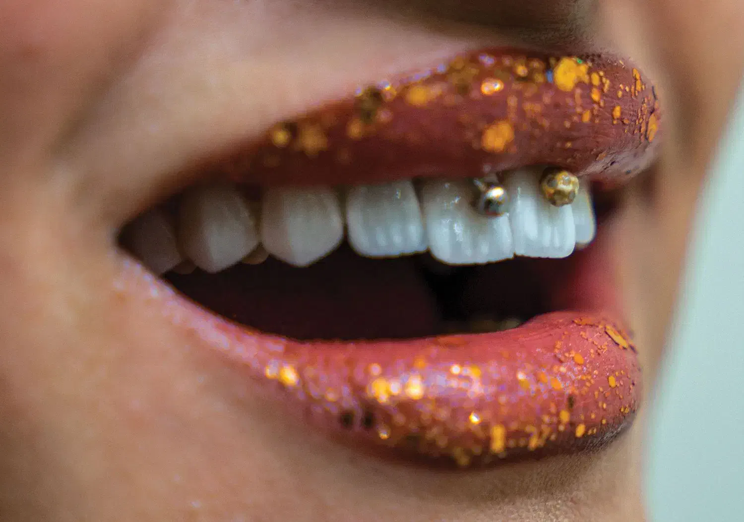 خدمات دهان و دندان|خدمات آرایشگری و زیبایی|خرم‌آباد, |دیوار