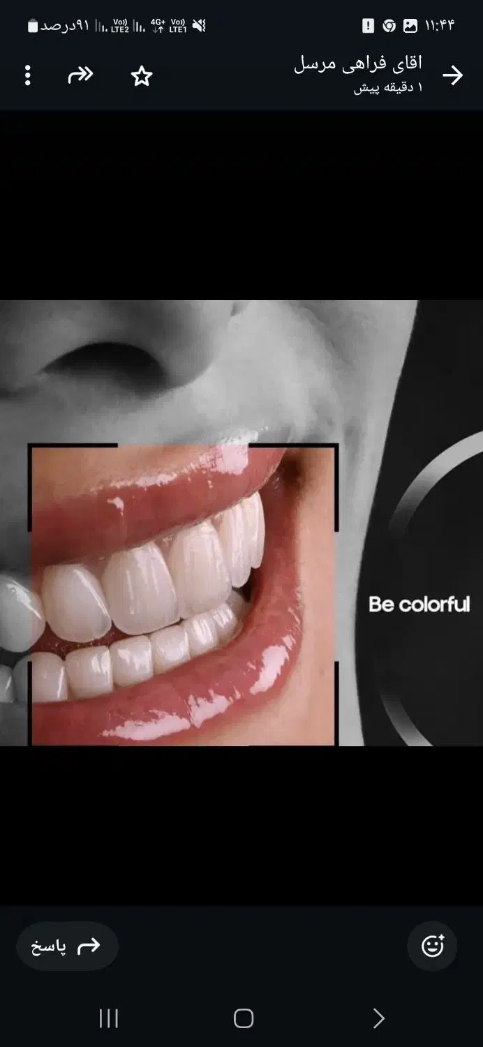 ثبت نام بیمه دندانپزشکی وکامپوزیت وزیبایی دندان|خدمات آرایشگری و زیبایی|گرگان, |دیوار