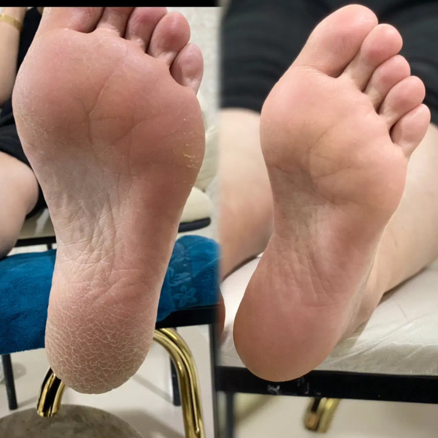 پدیکور پا|خدمات آرایشگری و زیبایی|سقز, |دیوار