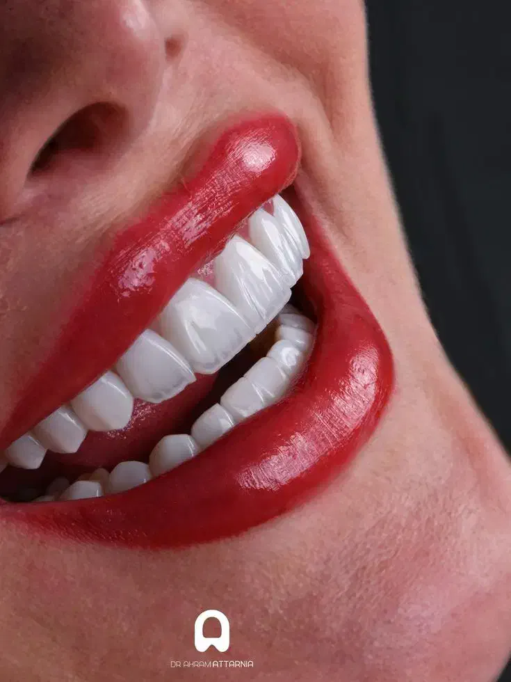 دوره آموزشی دستیار دندانپزشک(مهلت آخر)در سنندج|خدمات آموزشی|سنندج, |دیوار