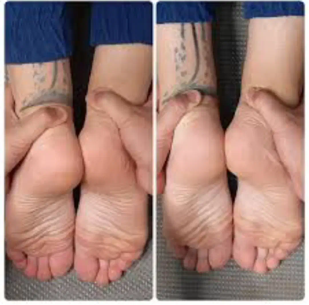 آزادسازی درد سیاتیک واصلاح آن|خدمات آرایشگری و زیبایی|قم, زنبیل آباد|دیوار