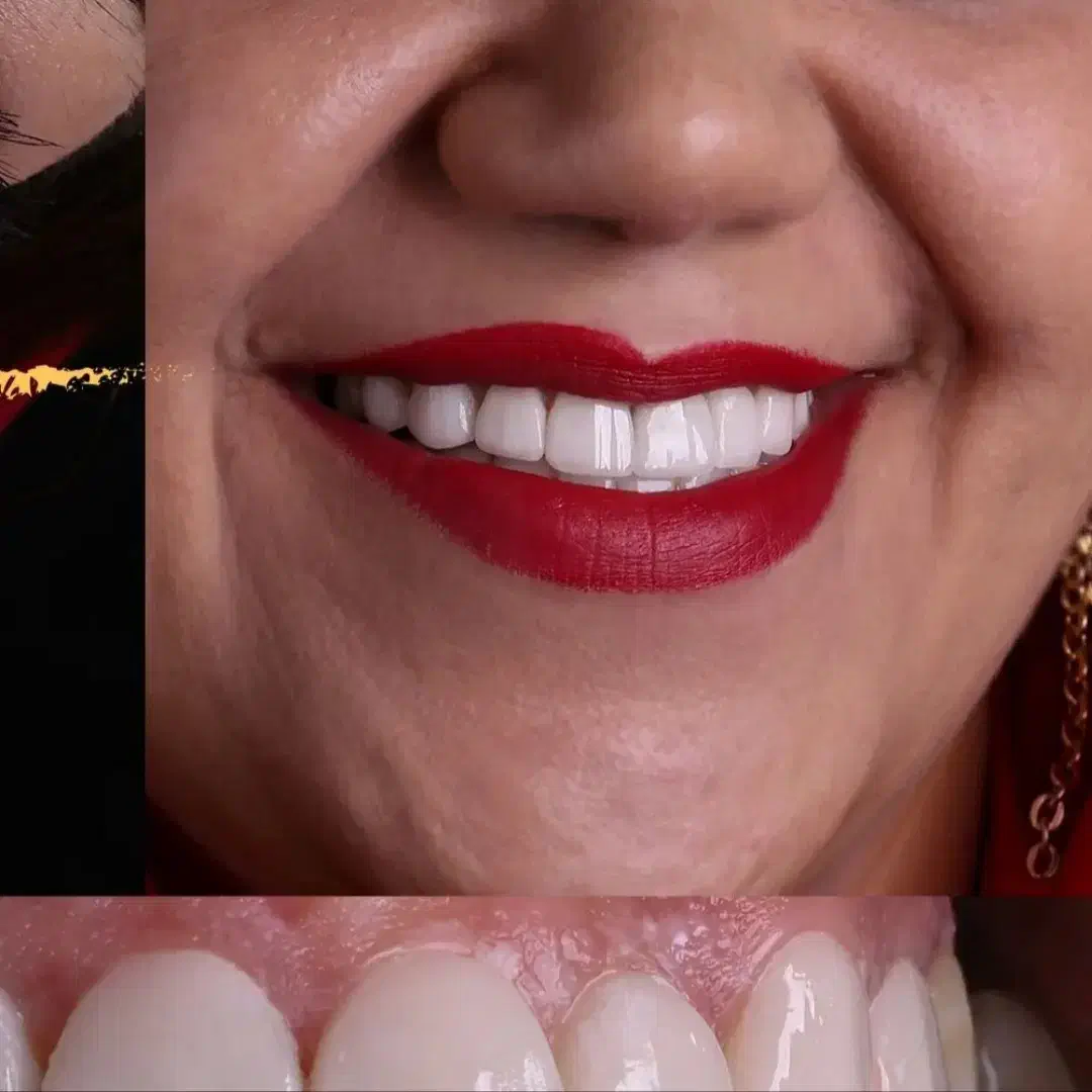 دندانپزشکی عصب کشی ترمیم کامپوزیت مناسب ترین قیمت|خدمات آرایشگری و زیبایی|مشهد, ده دی|دیوار