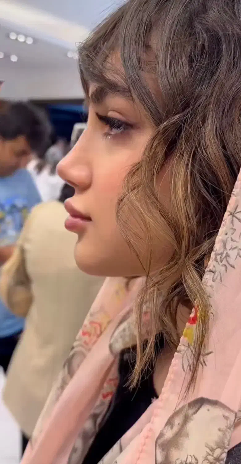 تخفیف ویژه عمل بینی/لیفت/لیپو/ابدو/پیکرتراشی|خدمات آرایشگری و زیبایی|کاشان, امیرکبیر|دیوار