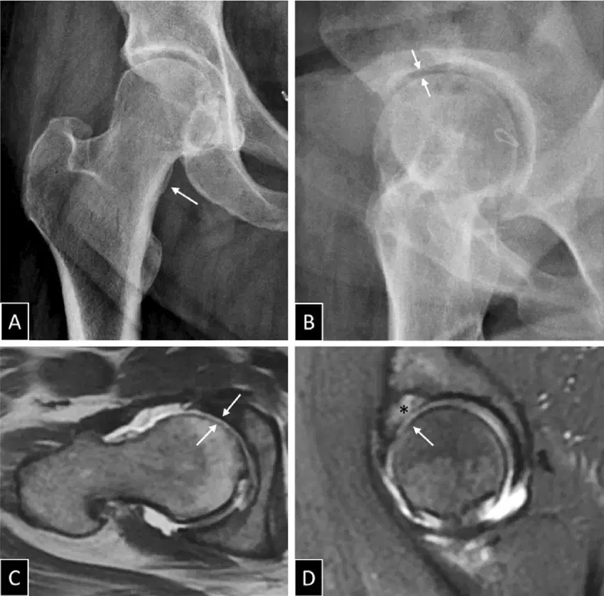 درمان رایگان بیماران مبتلا به سائیدگی مفصل ران|خدمات آرایشگری و زیبایی|اصفهان, دانشگاه اصفهان|دیوار
