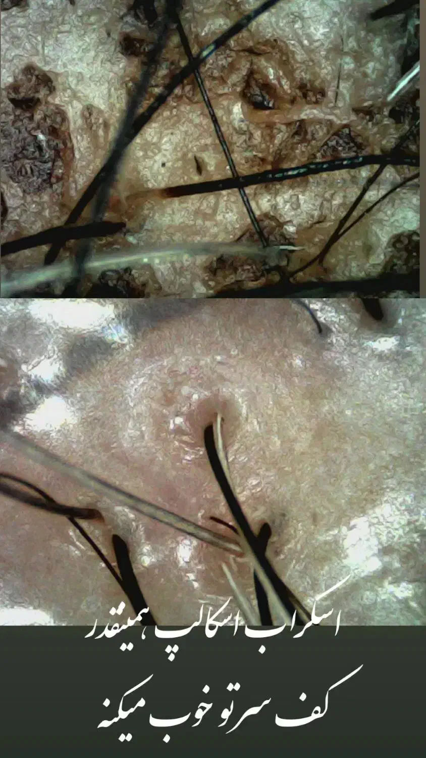 اسکالپ فردائم کراتین بافت مو|خدمات آرایشگری و زیبایی|یاسوج, |دیوار