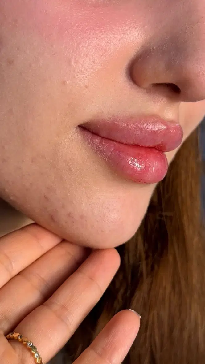 کلینیک زیبایی VIP ژل و بوتاکس تخصصی|خدمات زیبایی و سلامت|اصفهان, تیران|دیوار