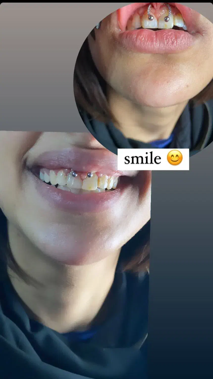 آموزش و اجرای پرسینگ|خدمات آرایشگری و زیبایی|نیشابور, ناسیونال|دیوار