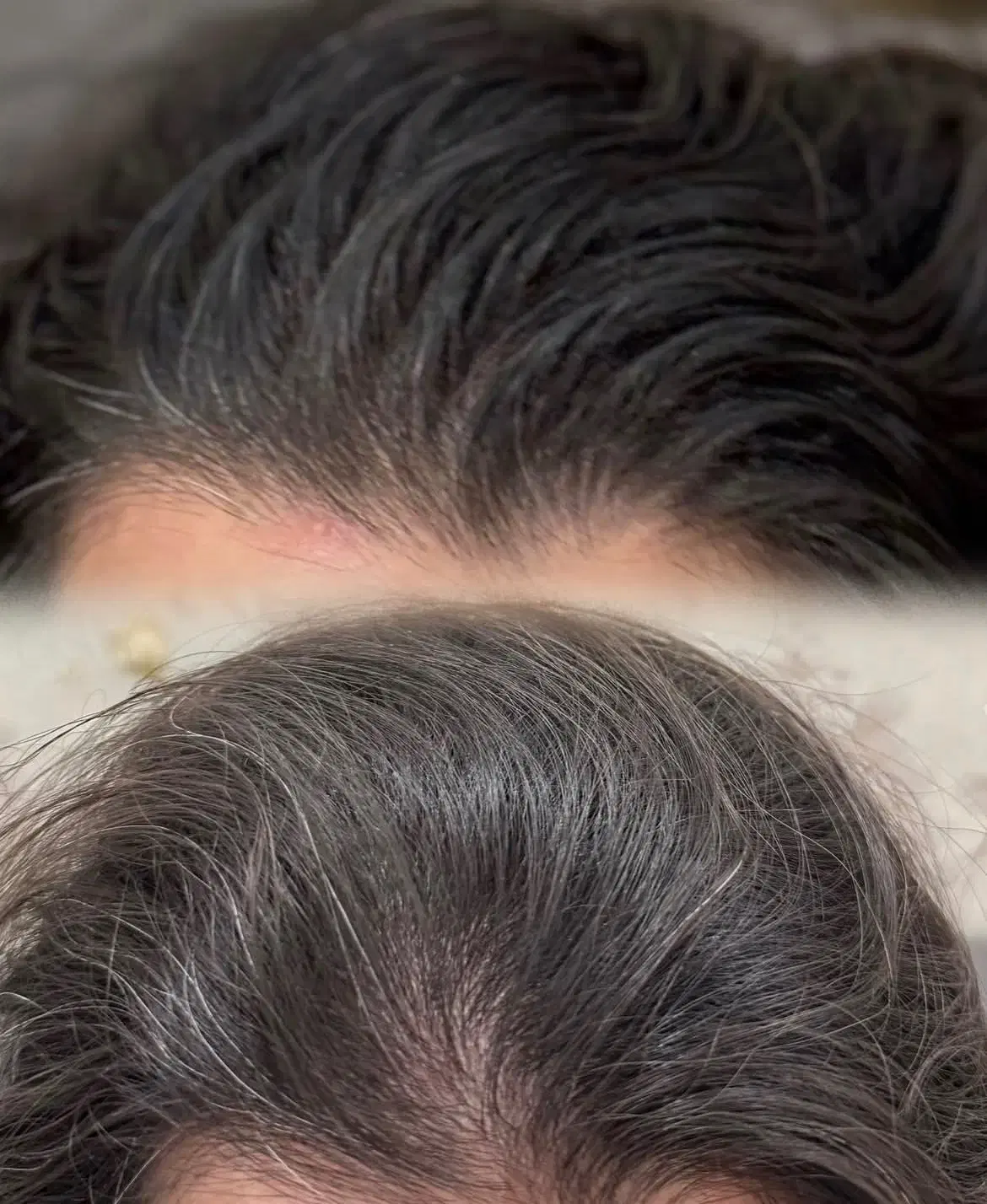 میکرواسکالپ سر|خدمات آرایشگری و زیبایی|جهرم, |دیوار