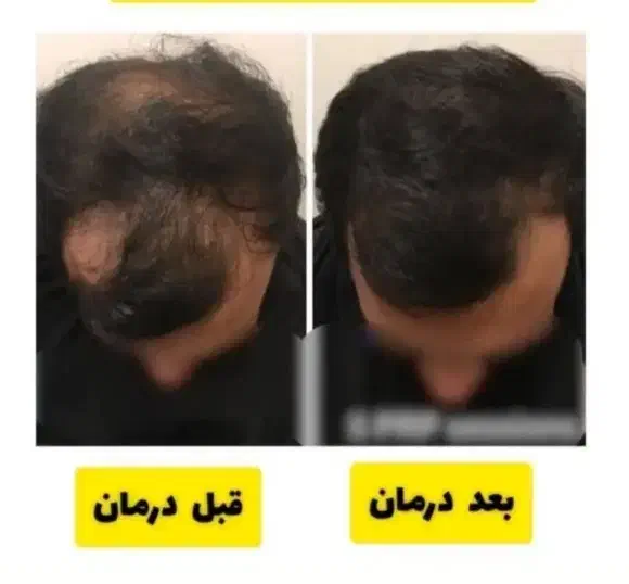 انواع شامپو و تقویت کننده مو و ضد ریزش و رویش مجدد|آرایشی، بهداشتی، درمانی|مرند, |دیوار