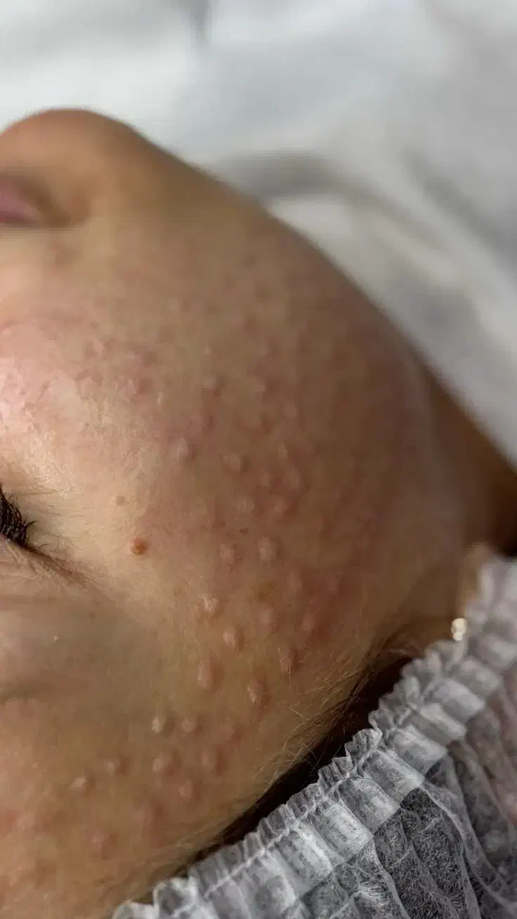 مرکز زیبایی با بروزترین دستگاه های روز دنیا|خدمات آرایشگری و زیبایی|ماهدشت, |دیوار