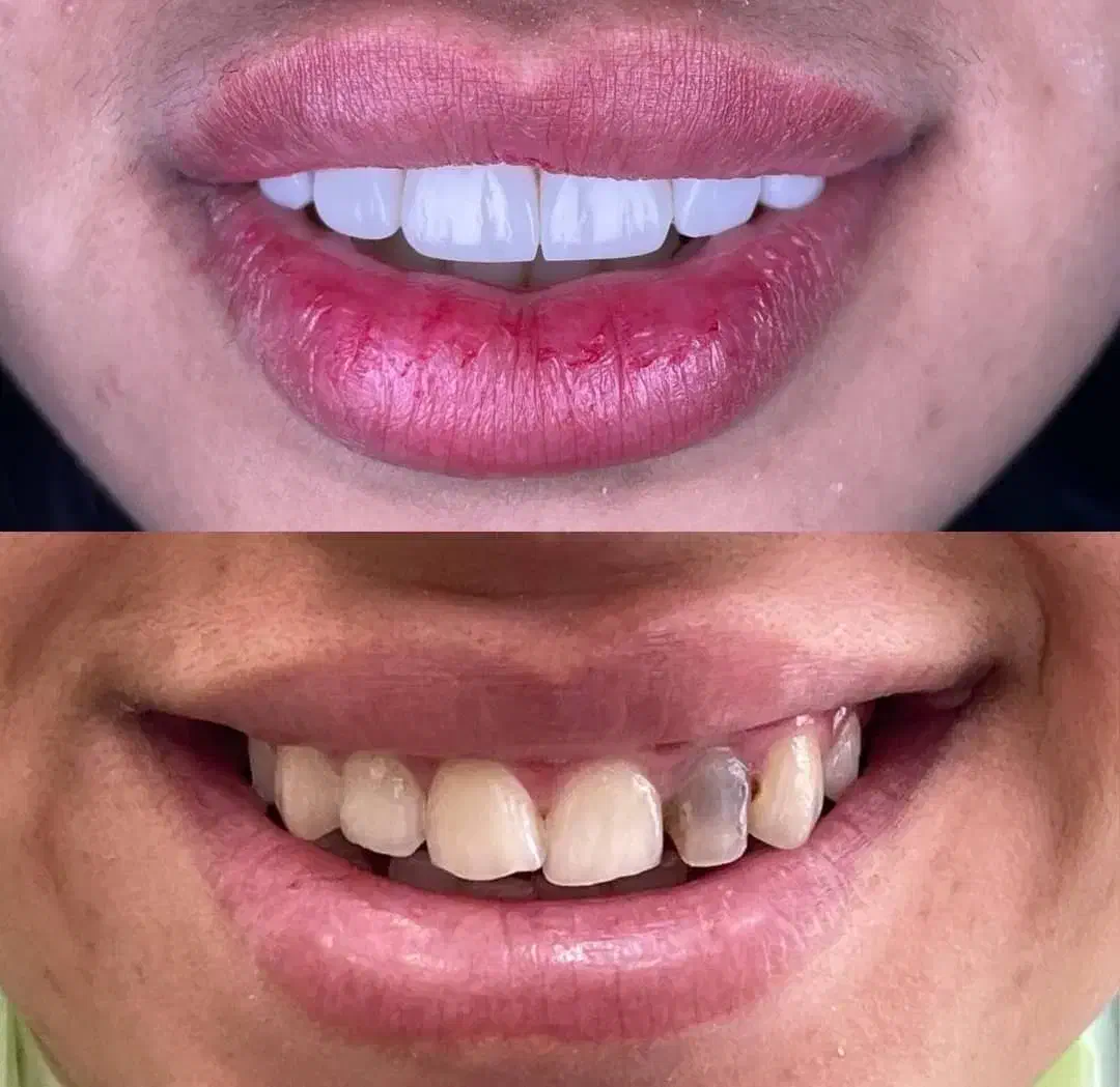 دندانپزشکی طرف قرارداد بیمه و اقساطی|خدمات آرایشگری و زیبایی|شیراز, قصرالدشت|دیوار