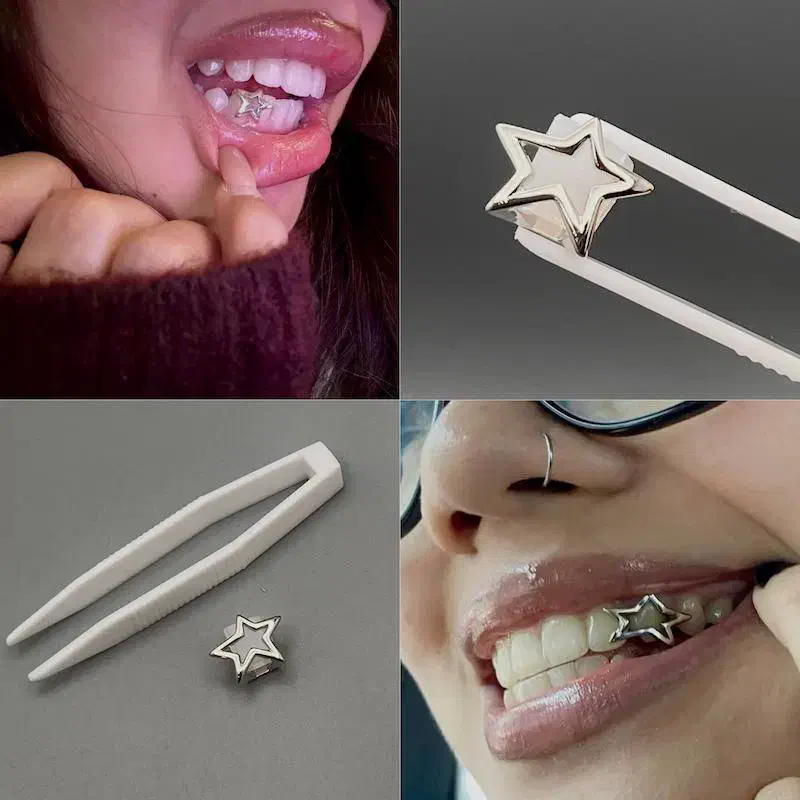 گریلز دندان|زیورآلات و اکسسوری|قم, سالاریه|دیوار