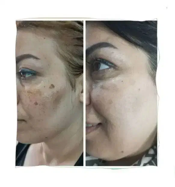 پاکسازی کبد فقط در ۴۰ روز|خدمات آرایشگری و زیبایی|گنبد کاووس, |دیوار