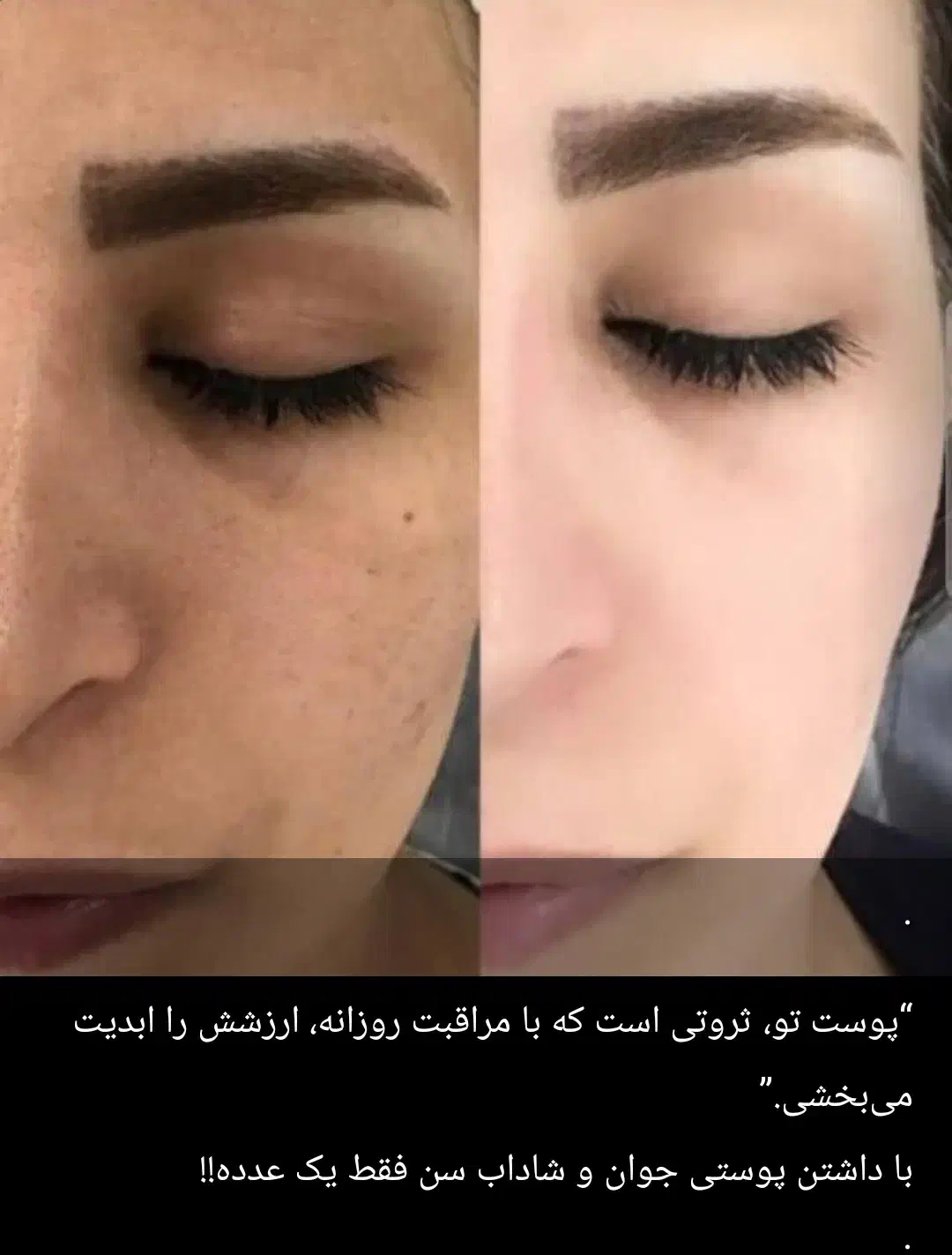 کرم سفید کننده صددرصد تضمینی|آرایشی، بهداشتی، درمانی|زابل, |دیوار