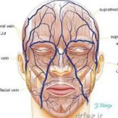 درمان سردردسینوزیت میگرن پادرد کبدچرب بادکش درمانی|خدمات آرایشگری و زیبایی|تبریز, |دیوار