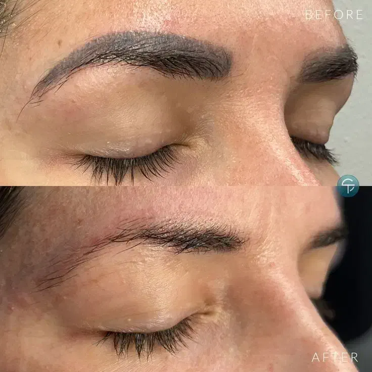 ریموو تخصصی تتوی ابرو و خط چشم و بدون آسیب|خدمات آرایشگری و زیبایی|بم, |دیوار