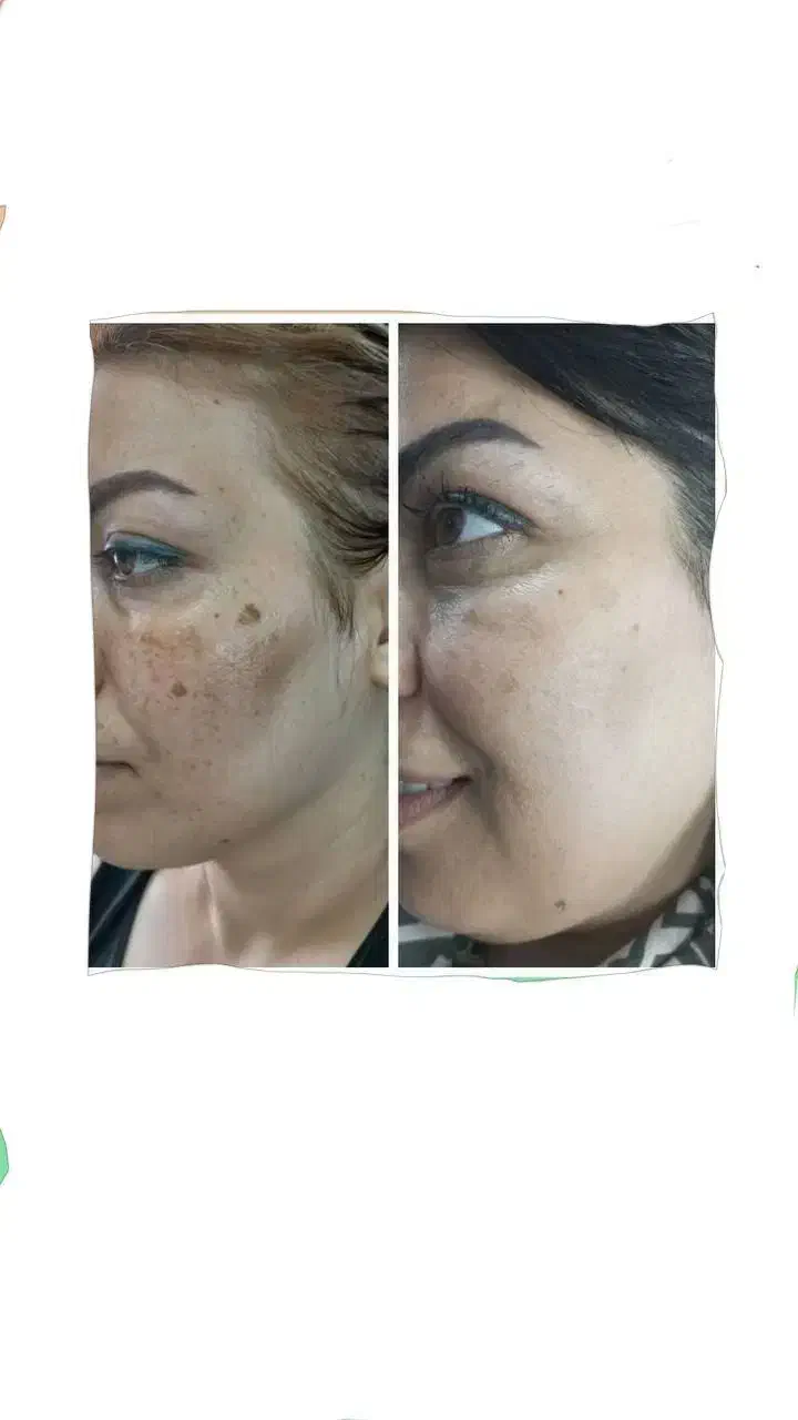 پاکسازی کبدچرب فقط در 40 روز|خدمات آرایشگری و زیبایی|گرگان, |دیوار