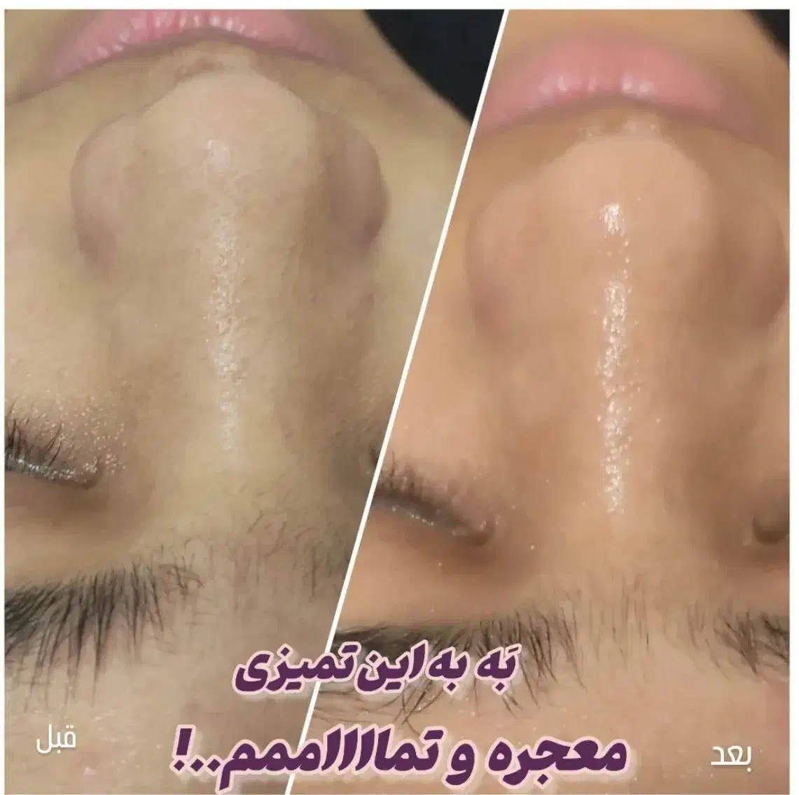 پاکسازی پوست فقط با ۴۸۰|خدمات آرایشگری و زیبایی|جیرفت, |دیوار