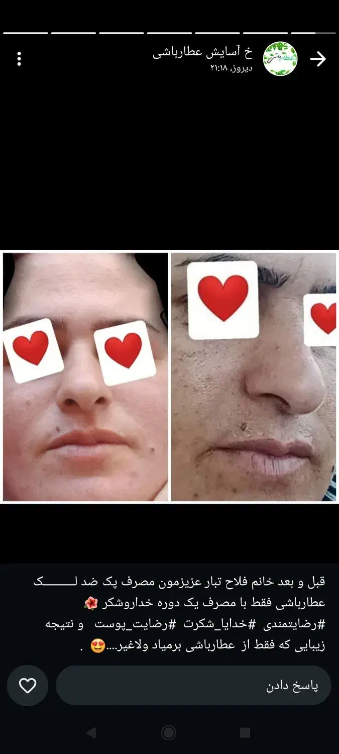 محصولات گیاهی درمانی|آرایشی، بهداشتی، درمانی|نیریز, |دیوار