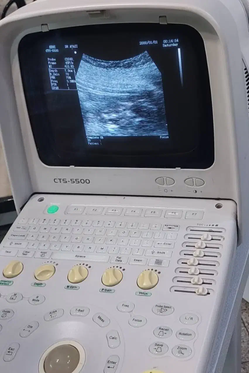 دستگاه سونوگرافی ۵۵۰۰سویی|آرایشی، بهداشتی، درمانی|تهران, باغ فیض|دیوار