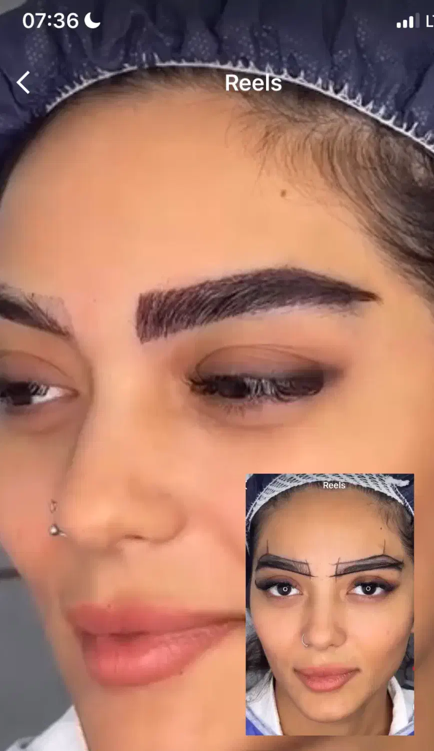 کاشت مو وابرو بدون سیخ سیخ شدن وبهترین خواب|خدمات آرایشگری و زیبایی|مشهد, احمدآباد|دیوار