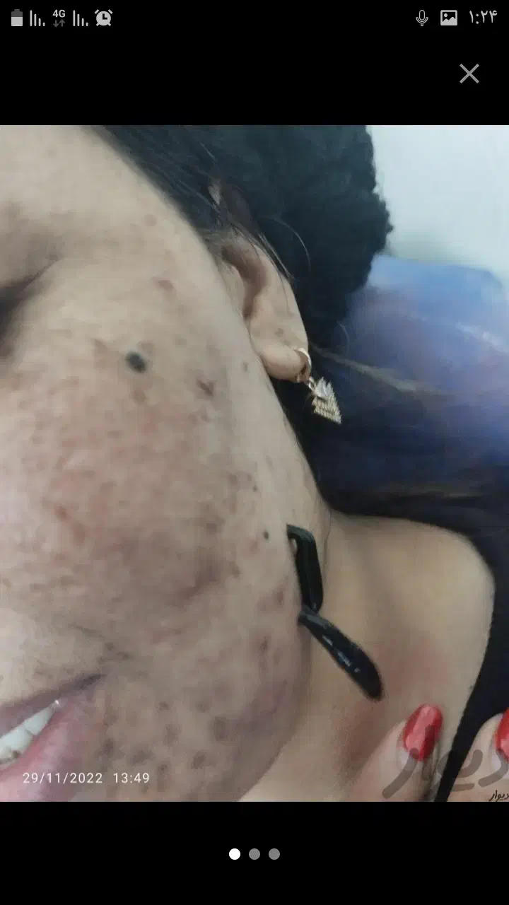 زالو|خزنده|زنجان, |دیوار