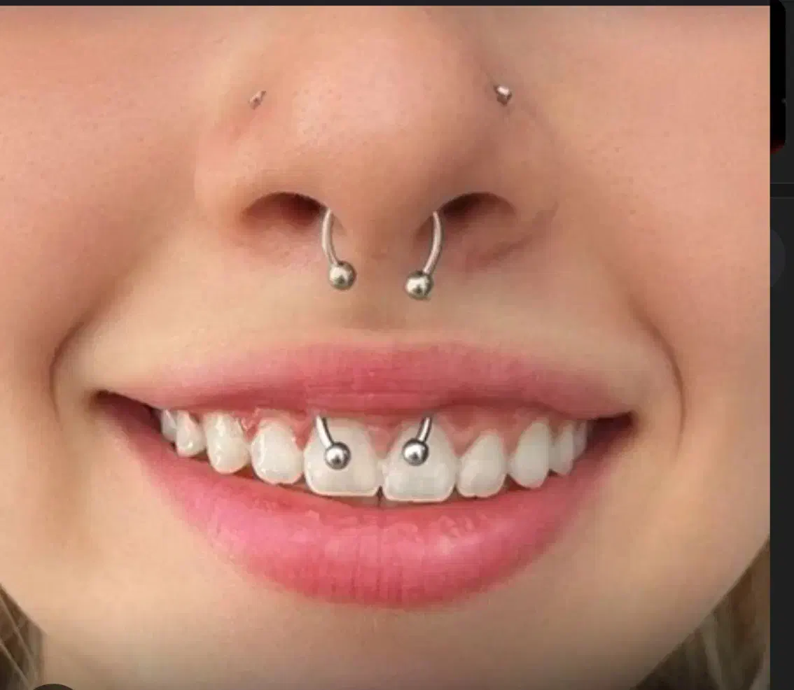 خدمات پزشکی،پیرسینگ|خدمات آرایشگری و زیبایی|زنجان, |دیوار