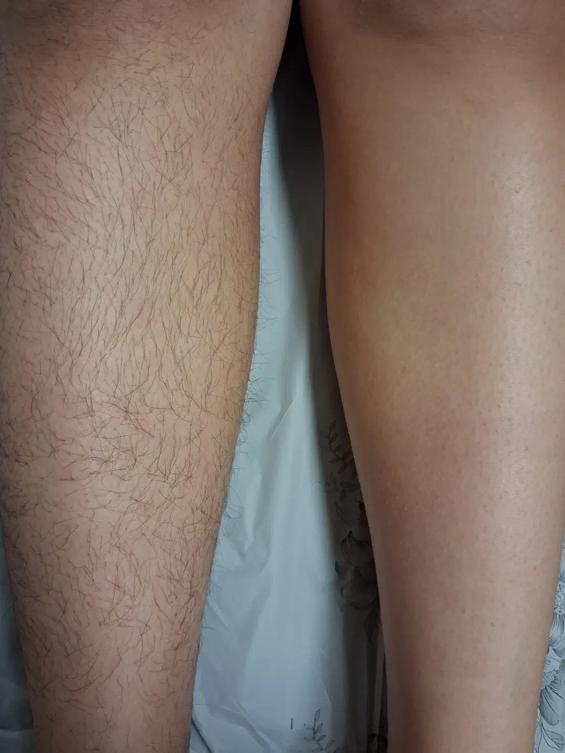 اپیلاسیون حرفه ای|خدمات آرایشگری و زیبایی|بروجرد, |دیوار