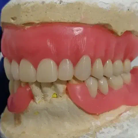 دندانسازی سپیددنتال|آرایشی، بهداشتی، درمانی|خرم‌آباد, |دیوار