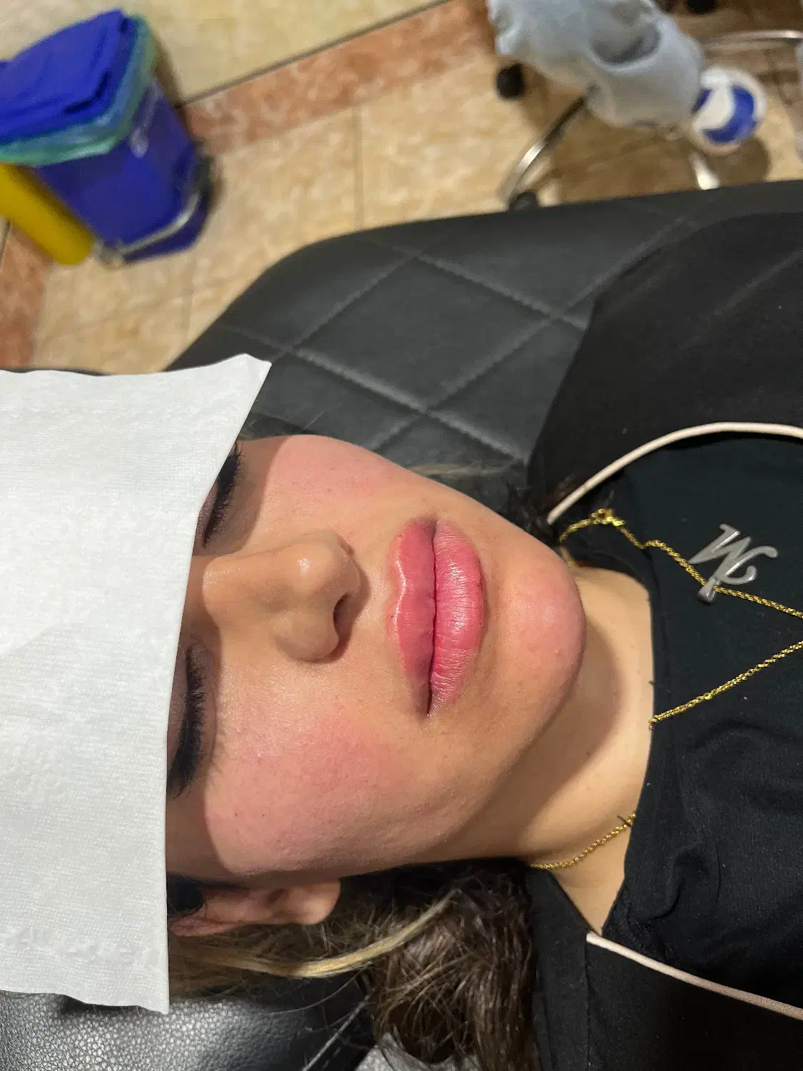 ژل بوتاکس|خدمات آرایشگری و زیبایی|دورود, |دیوار